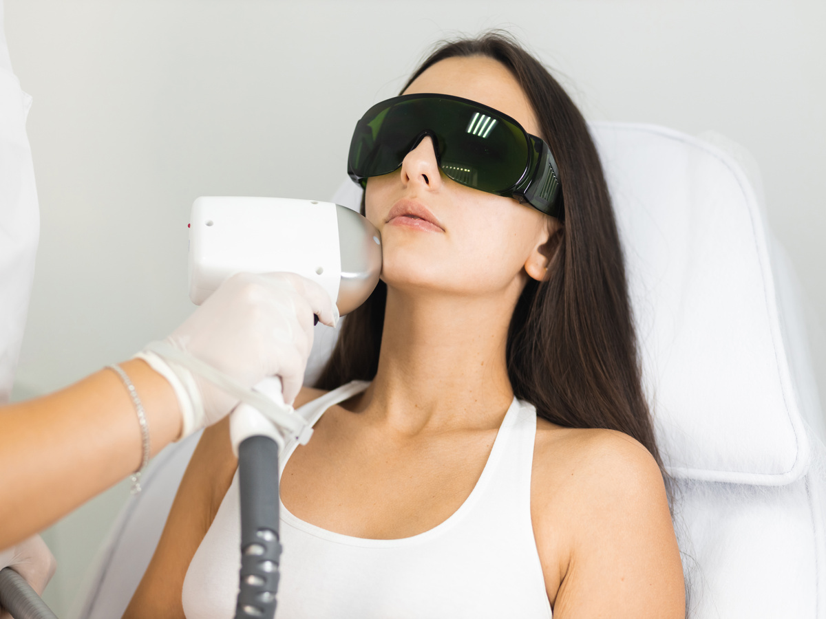 Is Laser Hair Removal Permanent? What to Expect