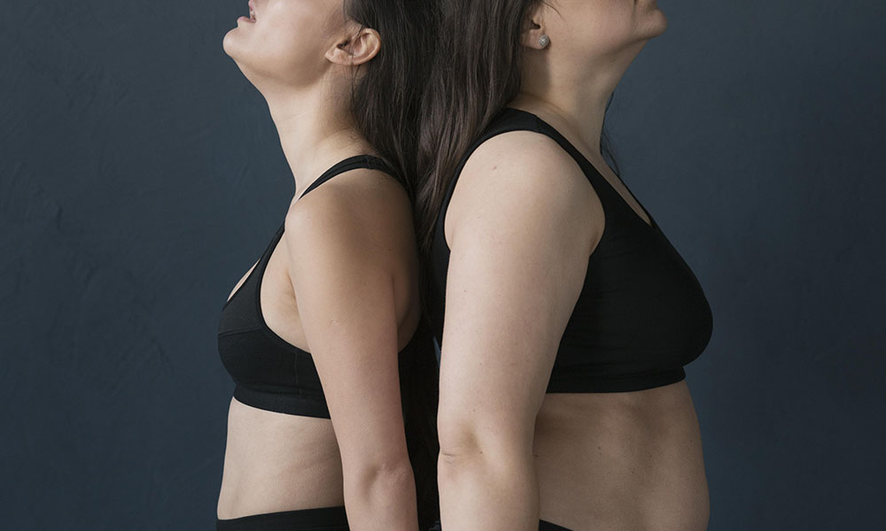 CoolSculpting vs liposuction