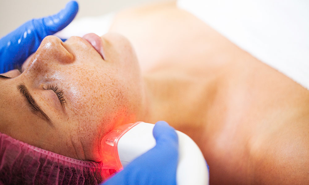 Laser skin tightening benefits