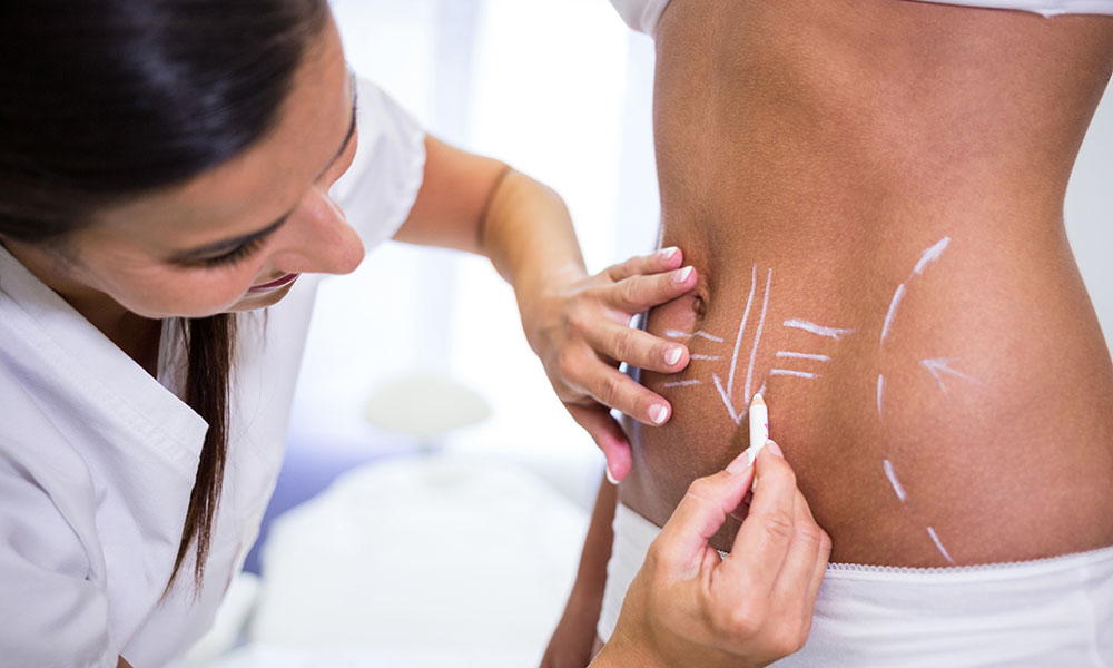 Post-body contouring expectations