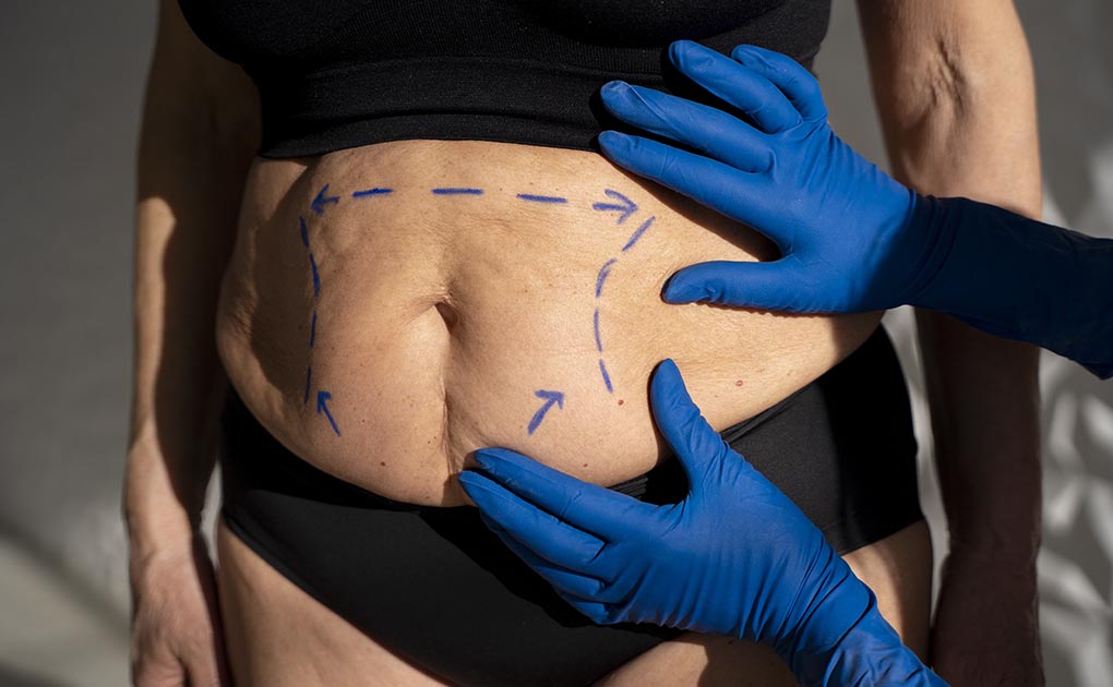 how much does body contouring cost